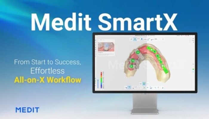 Medit Perkenalkan Medit SmartX: Solusi Digital Canggih untuk Implan Gigi