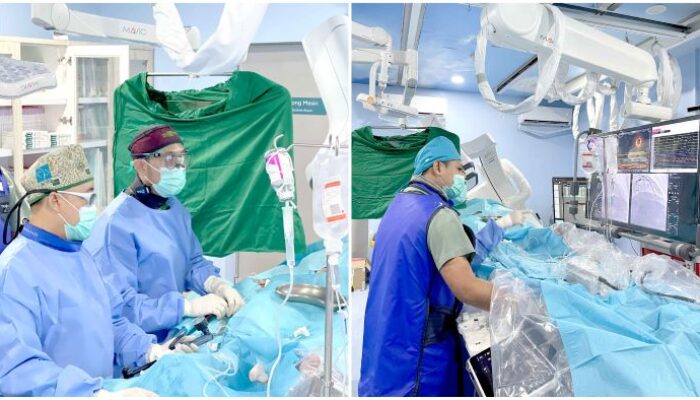 Teknologi Drug Eluting Balloon (DEB): Alternatif Tanpa Ring untuk Pasien Jantung Koroner