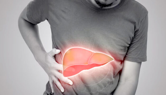 Jangan Tunggu Kuning: Hepatitis Masih Jadi Epidemi Diam yang Mengintai Jutaan Warga Indonesia
