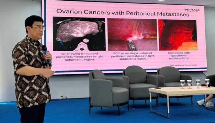 Primaya Hadirkan HIPEC, Terapi Kanker Peritoneal Lebih Efektif di RI